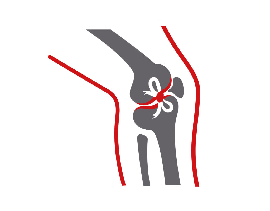 Knee Repair